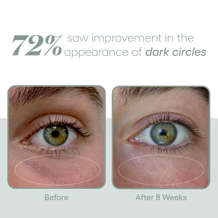 Plated Eye Exosome Serum Before and After Photo Dark Circles