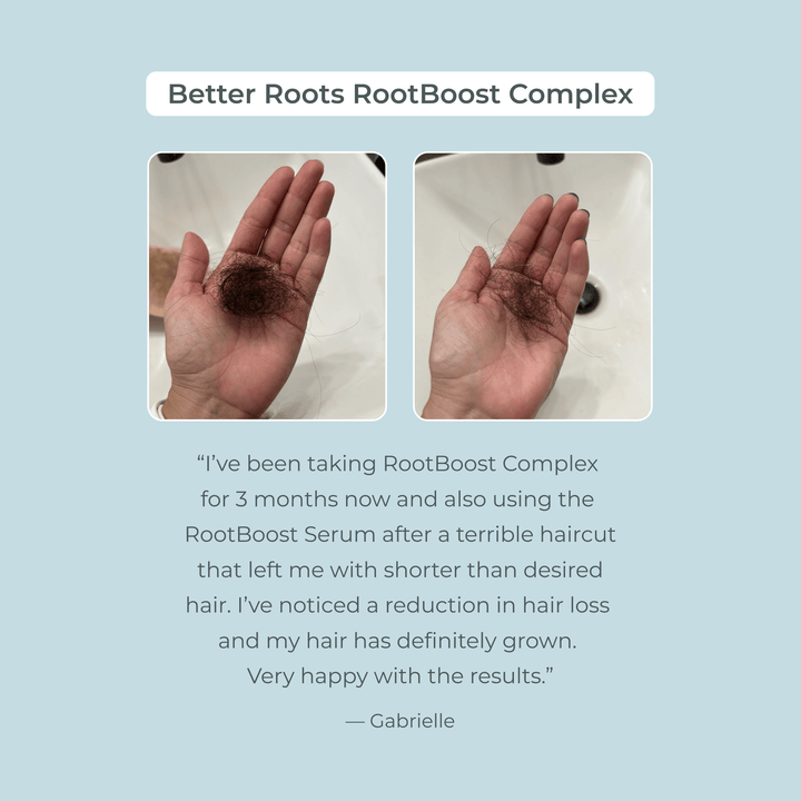 Honest Customer Review - EVOLVh Better Roots RootBoost Complex
